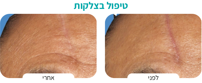 טיפול בגוון העורAsset 3