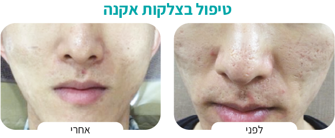 טיפול בגוון העורAsset 4